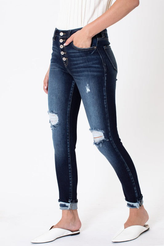Dark High Rise Button Down Cuffed Ankle Skinny Kan Can